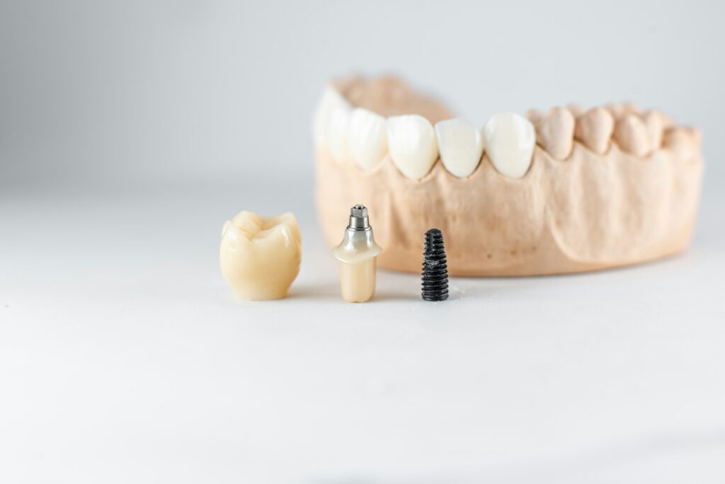 Model of artificial jaw and dental implant